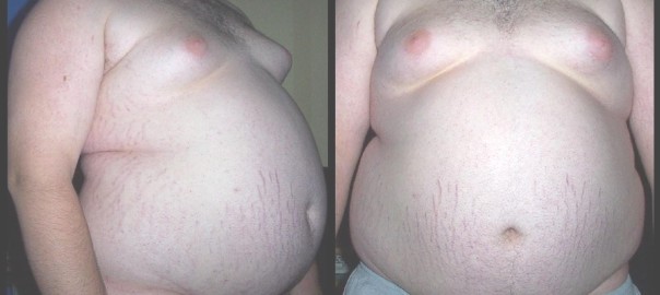 fat gut, not mine
